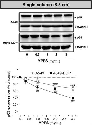 The Mechanisms of Yu Ping Feng San in Tracking the Cisplatin-Resistance by Regulating ATP-Binding Cassette Transporter and Glutathione S-Transferase in Lung Cancer Cells